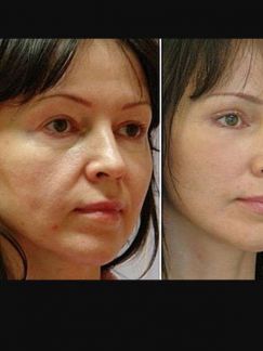 Массаж (скульптурирование, лифтинг,омоложение  Армавир