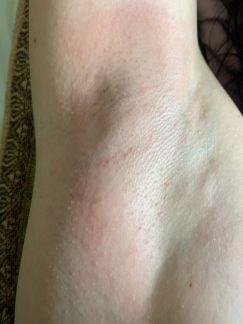 Шугаринг дипиляция  Армавир