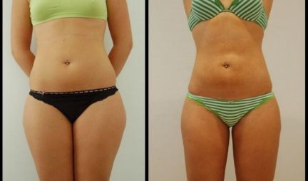 Массаж Севастополь  Армавир