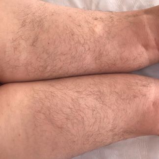 Депиляция(шугаринг,полимер,тёплый воск) в центре С  Армавир