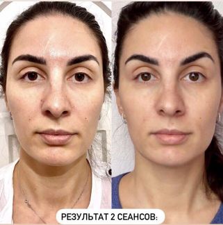 Массаж лица Евпатория  Армавир