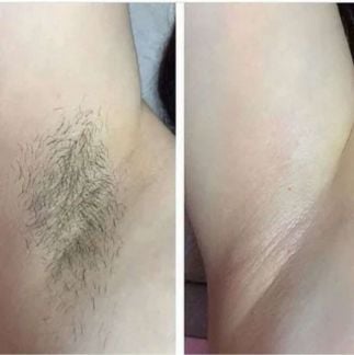 Восковая депиляция  - купить на сайте объявлений Армавир онлайн