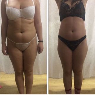 Услуги профессионального массажа  - купить на сайте объявлений Армавир онлайн